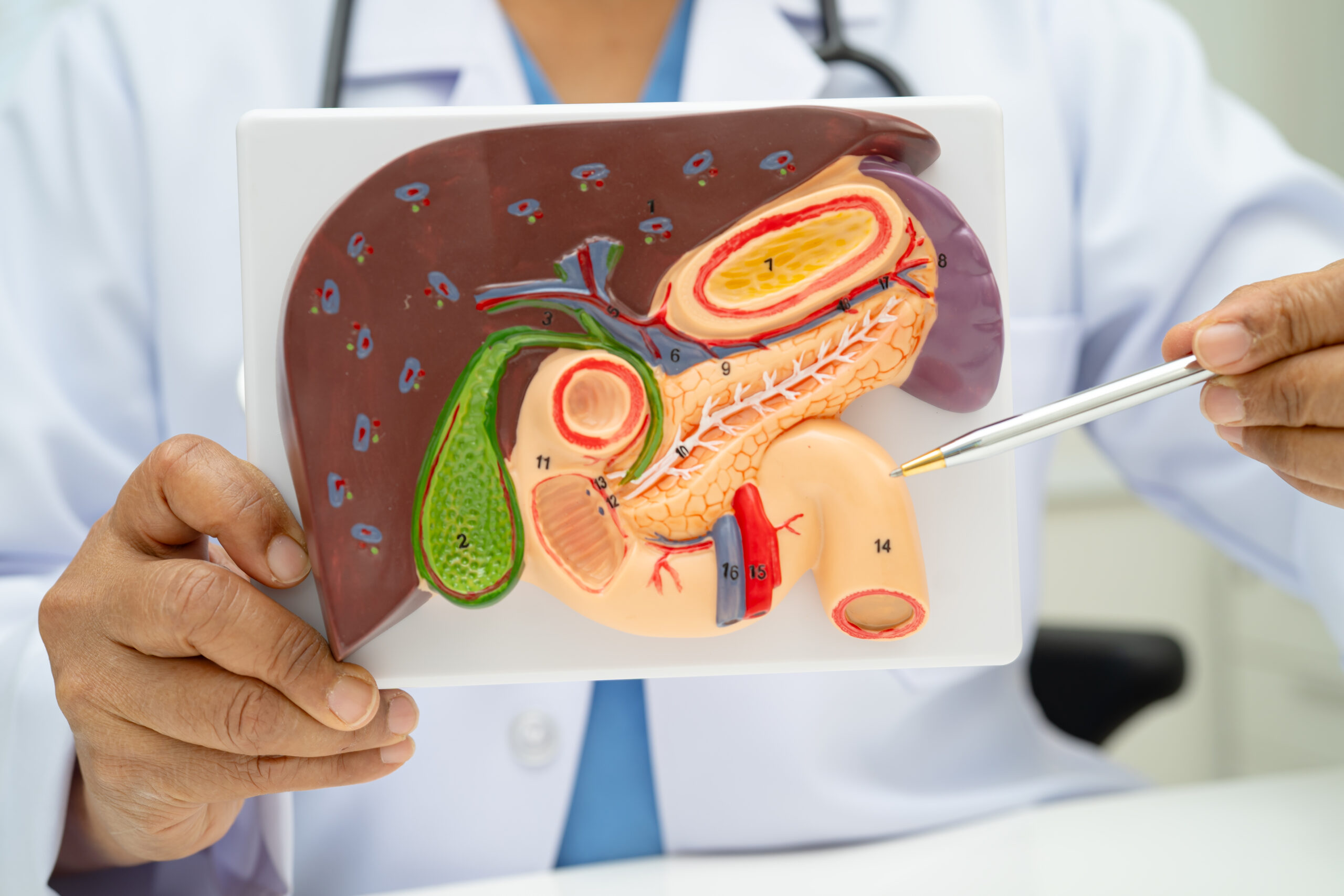 Pancreatic cancer is among the deadliest cancers: New drug is giving patients and doctors hope
