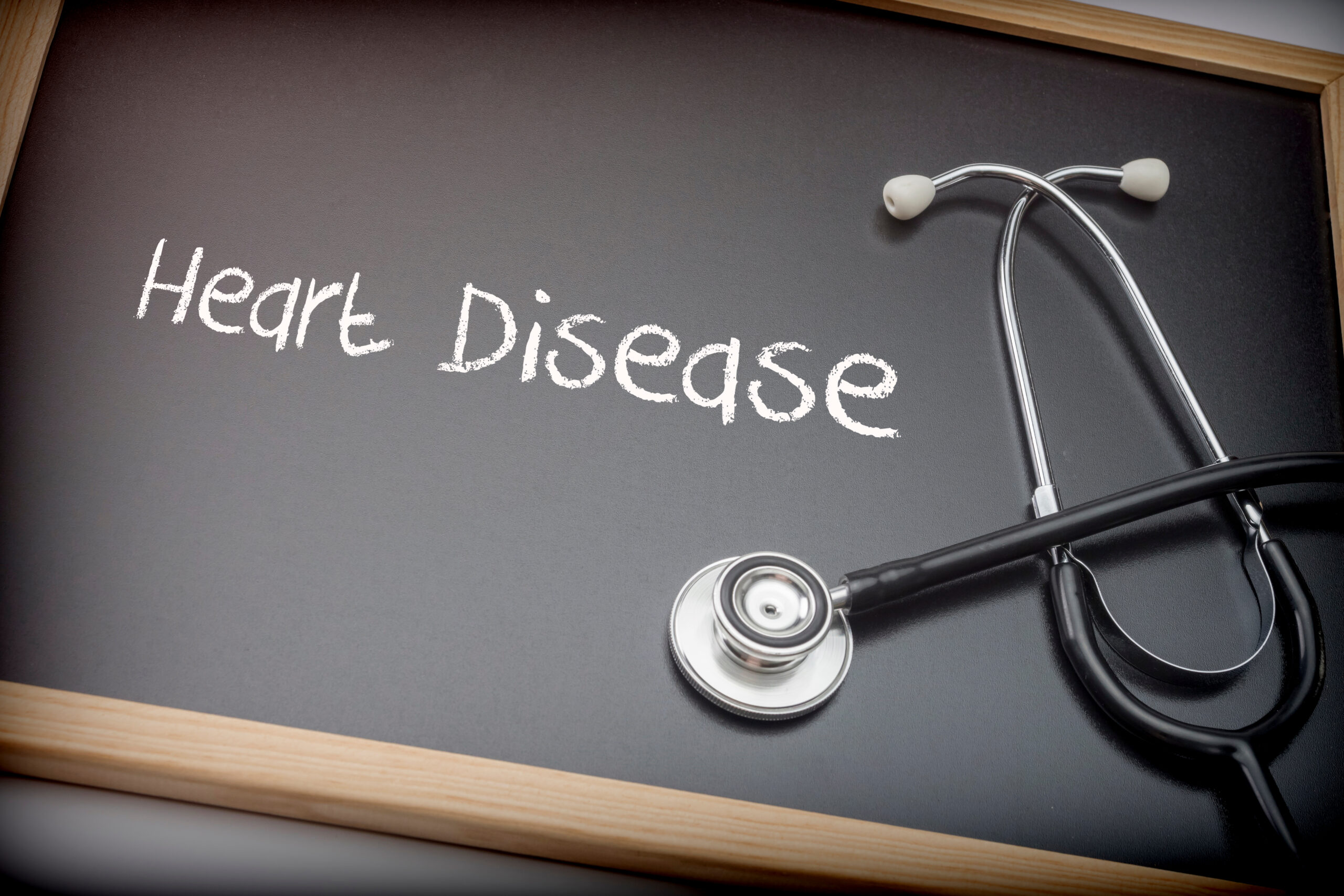 Almost 90% of heart disease deaths linked to preventable factors, study finds